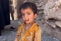 ببینید؛ وقتی سهم کودک از زندگی، هجوم مگس‌هاست