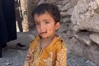 ببینید؛ وقتی سهم کودک از زندگی، هجوم مگس‌هاست