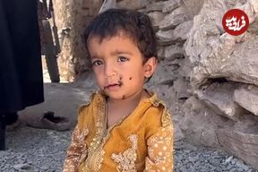 ببینید؛ وقتی سهم کودک از زندگی، هجوم مگس‌هاست