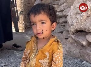 ببینید؛ وقتی سهم کودک از زندگی، هجوم مگس‌هاست