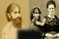 تصاویر| نوزادی که با سبیل به دنیا آمد! داستان عجیب ترین ستاره سیرک های جهان