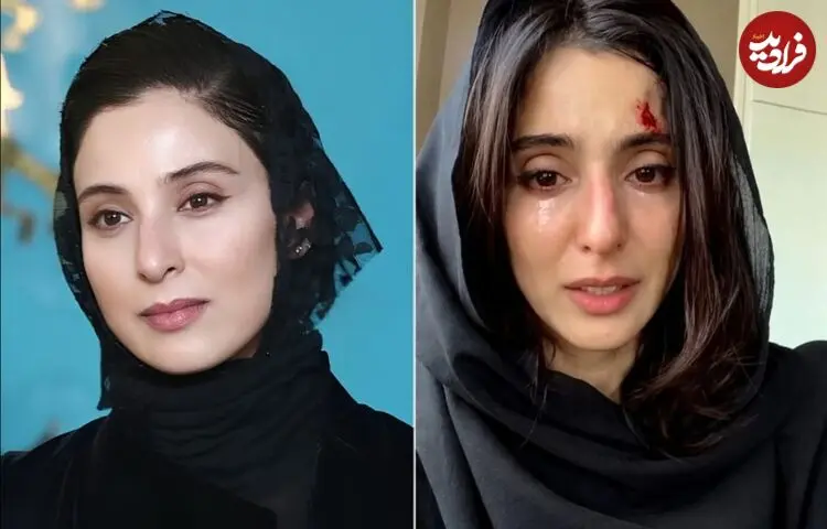 آناهیتا افشار و ماجرای یک ویدیو تبلیغاتی جنجالی؛ خلاقیت یا بازی با احساسات مردم؟