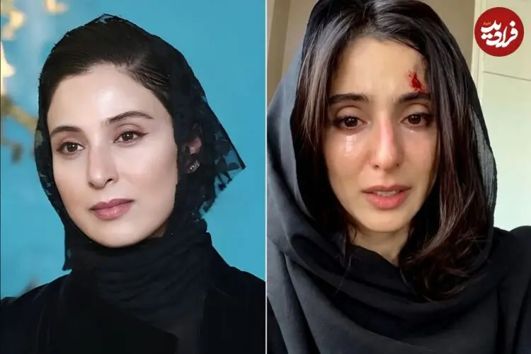 آناهیتا افشار و ماجرای یک ویدیو تبلیغاتی جنجالی؛ خلاقیت یا بازی با احساسات مردم؟