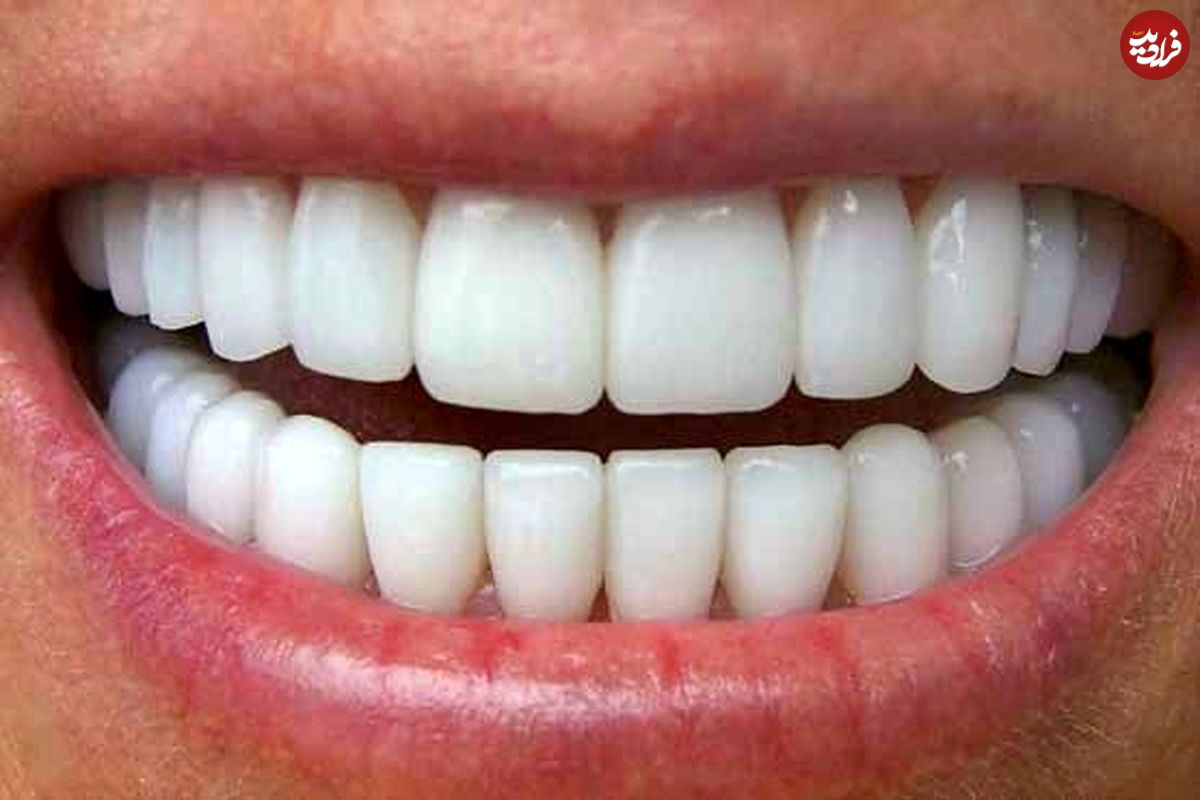 (اینفوگرافیک) ۱۰ نکته درباره رعایت بهداشت دندان