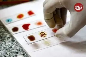 خون طلایی چیست و چرا دانشمندان در تلاش هستند تا نایاب‌ترین گروه خونی جهان را در آزمایشگاه بسازند؟