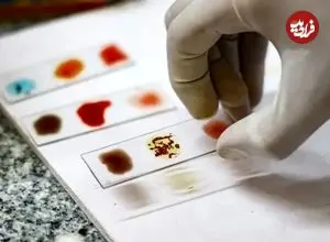 خون طلایی چیست و چرا دانشمندان در تلاش هستند تا نایاب‌ترین گروه خونی جهان را در آزمایشگاه بسازند؟