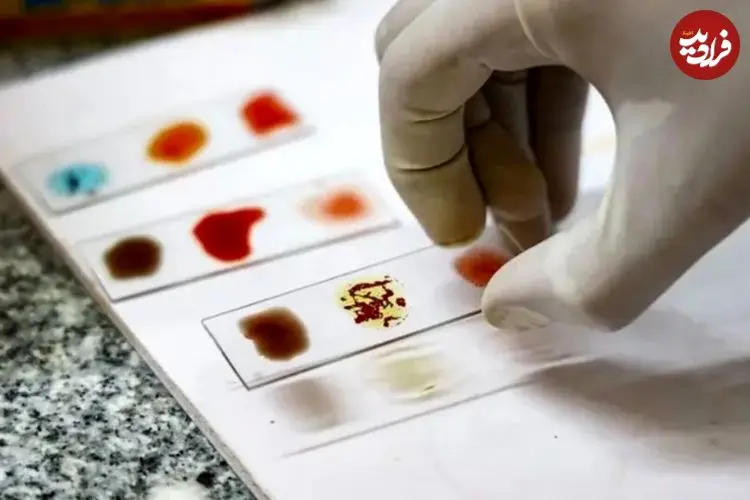 خون طلایی چیست و چرا دانشمندان در تلاش هستند تا نایاب‌ترین گروه خونی جهان را در آزمایشگاه بسازند؟