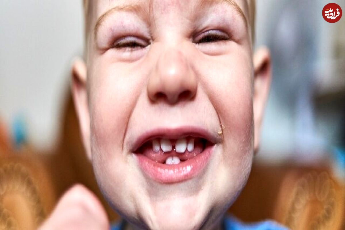 چرا قلقلک باعث خنده ما میشود؟