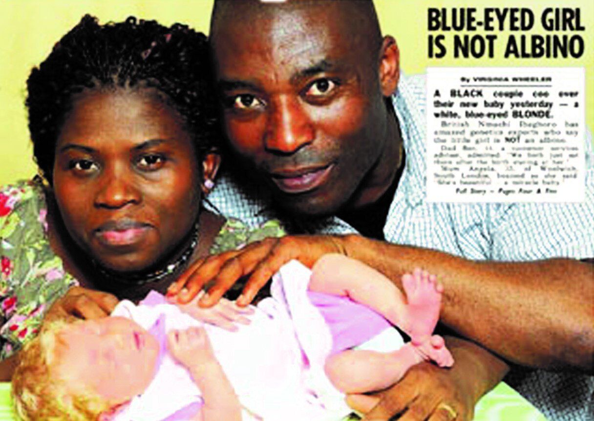 تولد نوزاد بلوند در یک خانواده سیاه