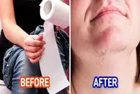 ۶ چیزی که نمی دانستید موهای زائد صورت را بیشتر می کنند