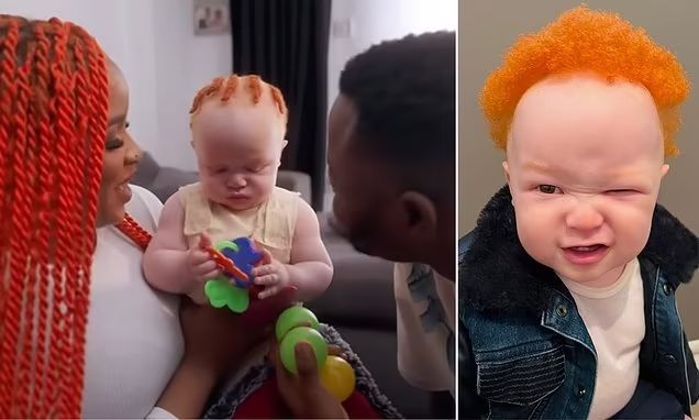 به دنیا آمدن نوزادی زال با موهای نارنجی از پدر و مادری سیاه پوست