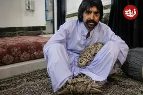 ببینید| مرد درختی برای درمان راهی آمریکا شد
