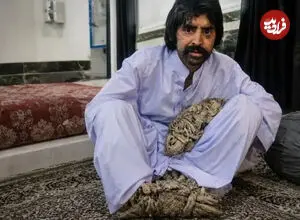ببینید| مرد درختی برای درمان راهی آمریکا شد