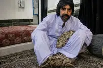 ببینید| مرد درختی برای درمان راهی آمریکا شد
