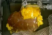 ساخت «کلیه جهانی» سازگار با هر گروه خونی