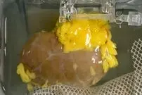 ساخت «کلیه جهانی» سازگار با هر گروه خونی