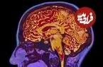 کشف تغییری پنهان در مغز که از حدود ۵۰ سالگی آغاز می‌شود