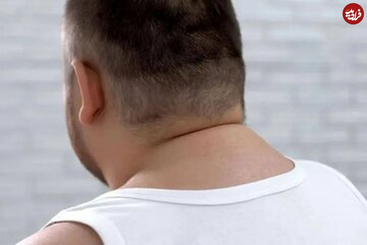 اندازه گردن چه چیزی در مورد سلامتی شما میگوید؟