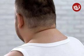 اندازه گردن چه چیزی در مورد سلامتی شما می‌گوید؟