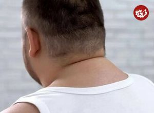 اندازه گردن چه چیزی در مورد سلامتی شما میگوید؟