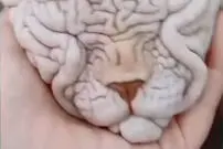 (ویدیو) صورت این گربه شبیه مغز انسان است!