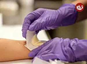 با این روش زخم شما در کسری از ثانیه درمان خواهد شد!