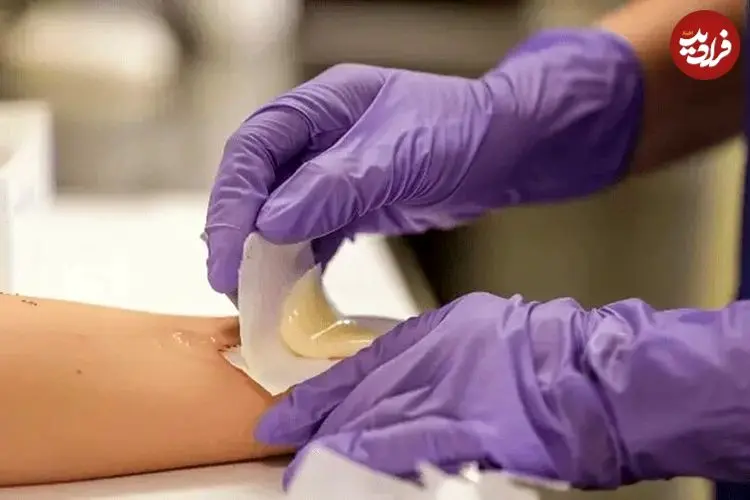 با این روش زخم شما در کسری از ثانیه درمان خواهد شد!