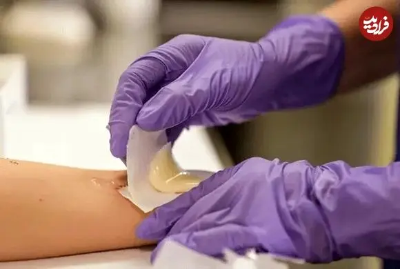 با این روش زخم شما در کسری از ثانیه درمان خواهد شد!