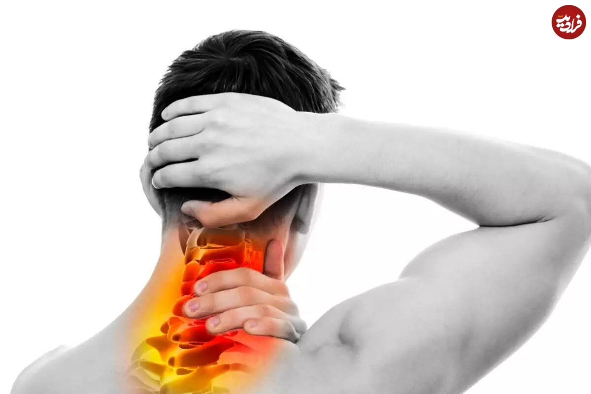 آرتروز گردن یا اسپوندیلوز گردنی چیست؟