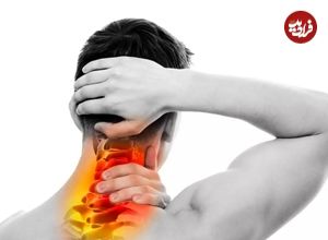 آرتروز گردن یا اسپوندیلوز گردنی چیست؟