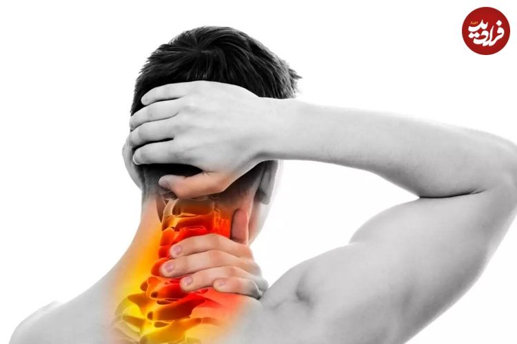 آرتروز گردن یا اسپوندیلوز گردنی چیست؟