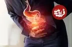 ۵ علامت مهم سرطان معده را بشناسید
