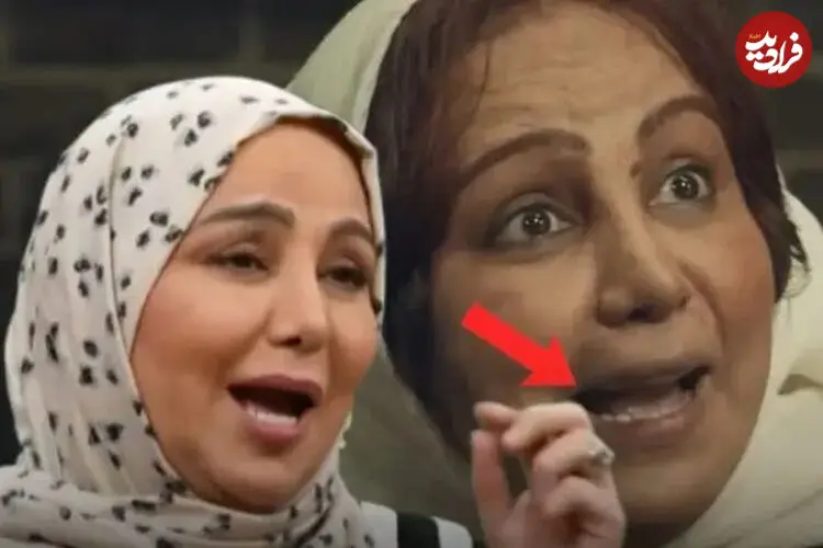 ببینید| بهنوش بختیاری: برای بامداد خمار دندان‌هایم را تراشیدم