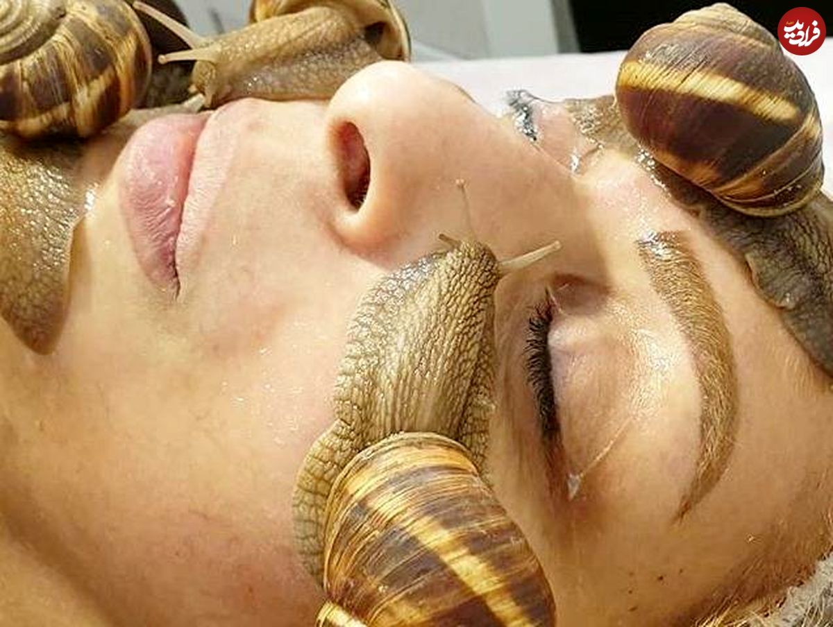 حلزون جای بوتاکس را میگیرد؟