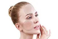 ۶ عادت صحیح برای تمیز کردن پوست‌های ترکیبی