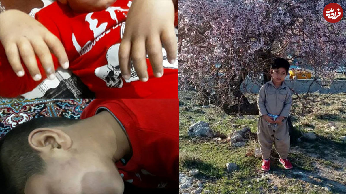 تنبیه بدنی دانش آموز ۷ ساله در ایلام