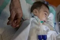 ابداع یک درمان جدید برای آتروفی عضلانی نخاعی
