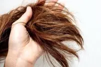 روشی مهم و کاربردی برای توقف ریزش مو