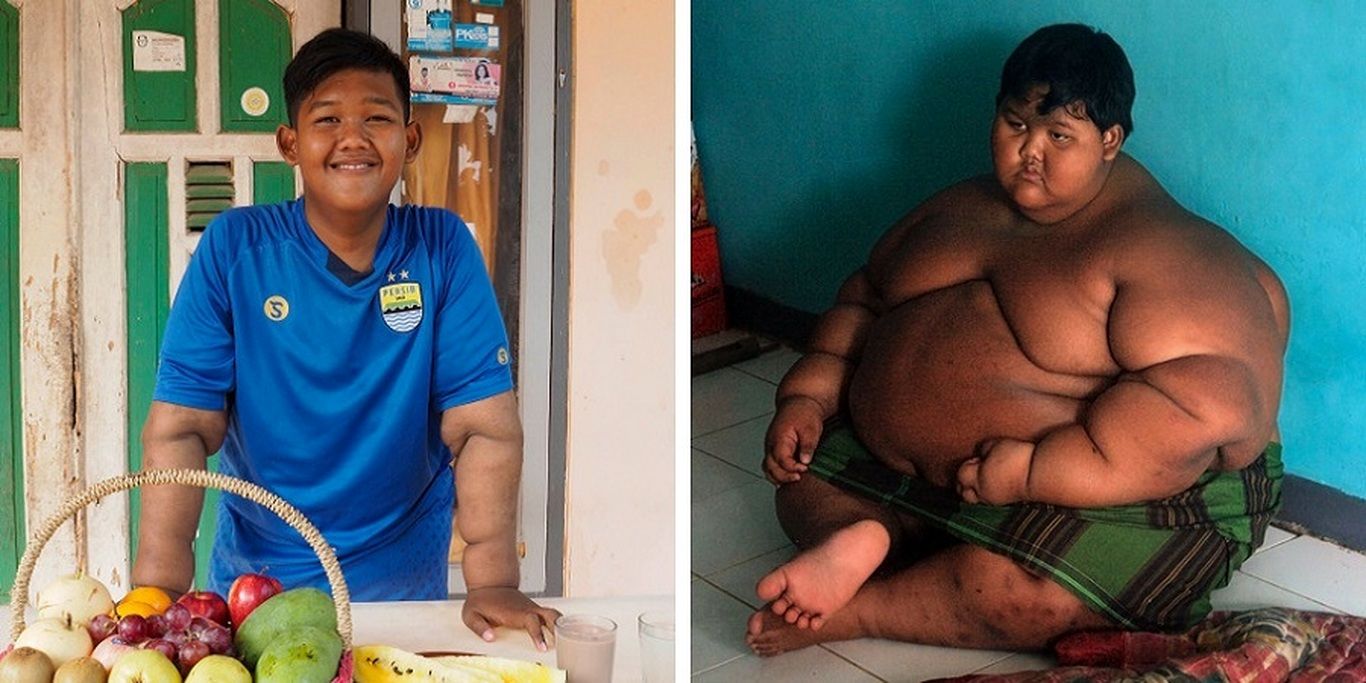 (تصاویر) آریا پرمانا چاق‌ترین کودک دنیا که با کاهش وزن خود شگفتی ساز شد