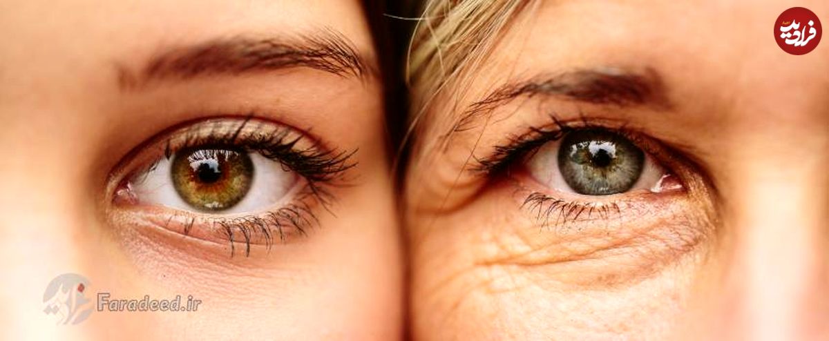 چگونه یک عمر چشمانی سالم داشته باشیم؟