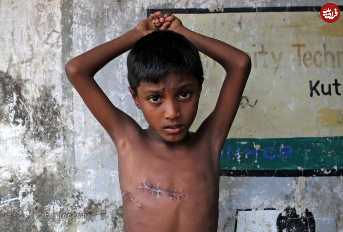 تصاویر/ چهره درناک آوارگان میانمار