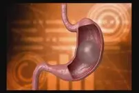 بالون معده؛ کاهش وزن بدون جراحی