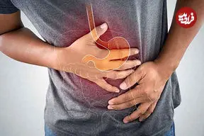 ۲ راهکار ساده برای کاهش علائم رفلاکس معده