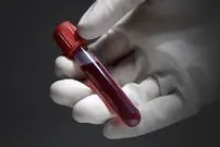 چطور می‌توان سرطان ریه را سریع تشخیص داد؟