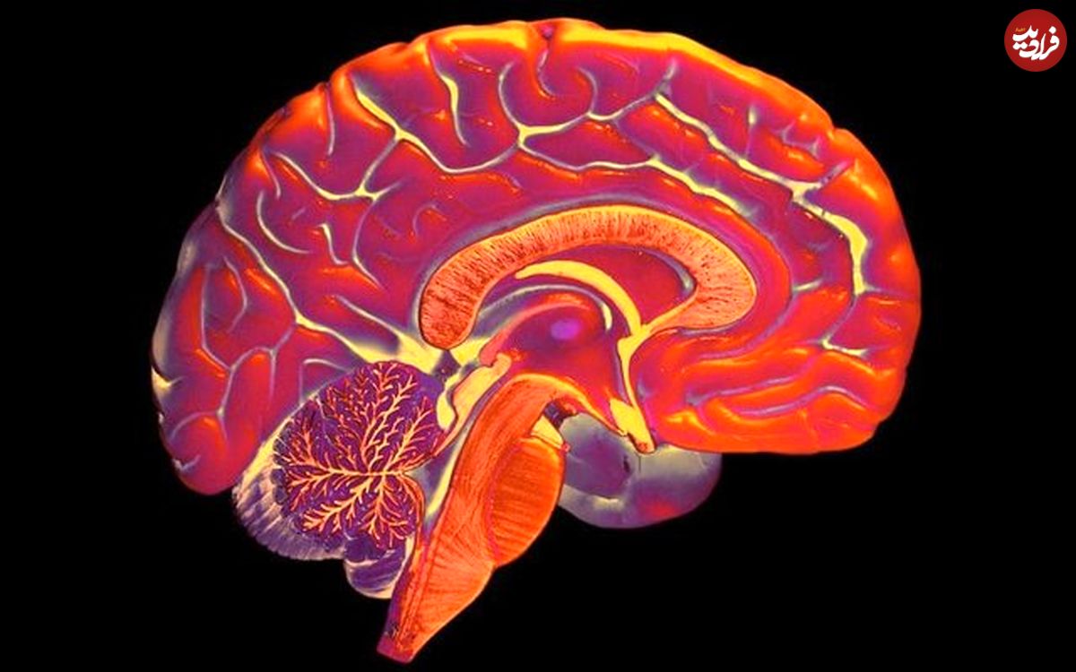 پرورش مینی‌مغز برای ترمیم مغز بیماران آلزایمر