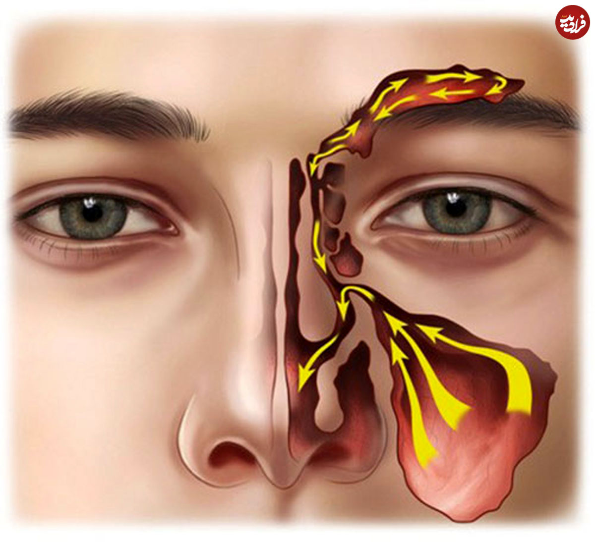 رنگ مخاط بینی و شرایط سلامت شما