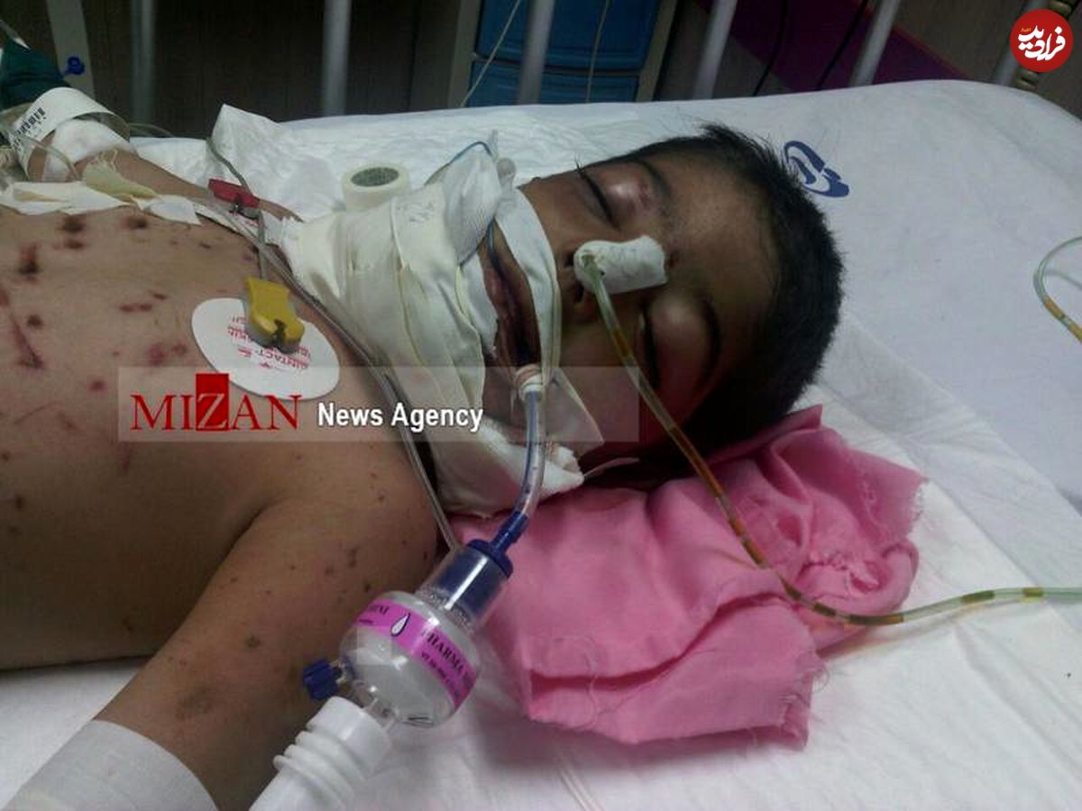 حمله گرگ به کودک 3 ساله در کرمانشاه