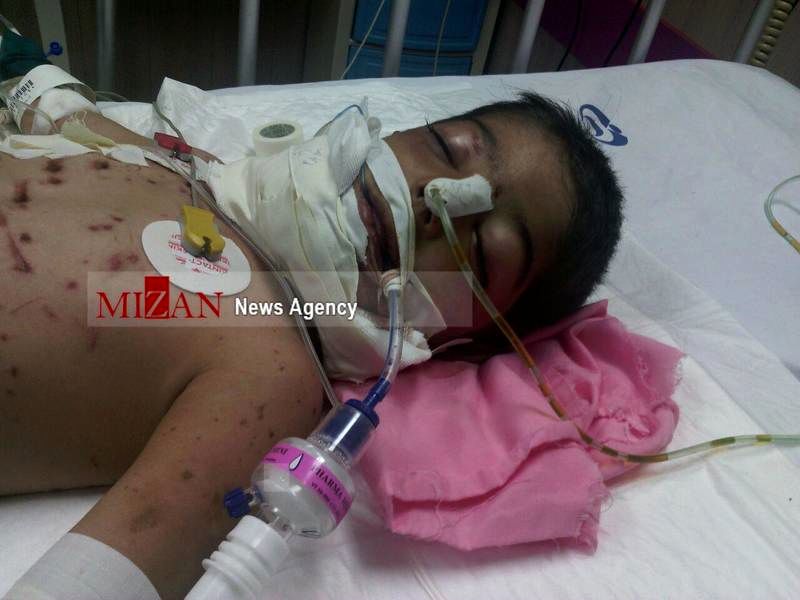 حمله گرگ به کودک 3 ساله در کرمانشاه