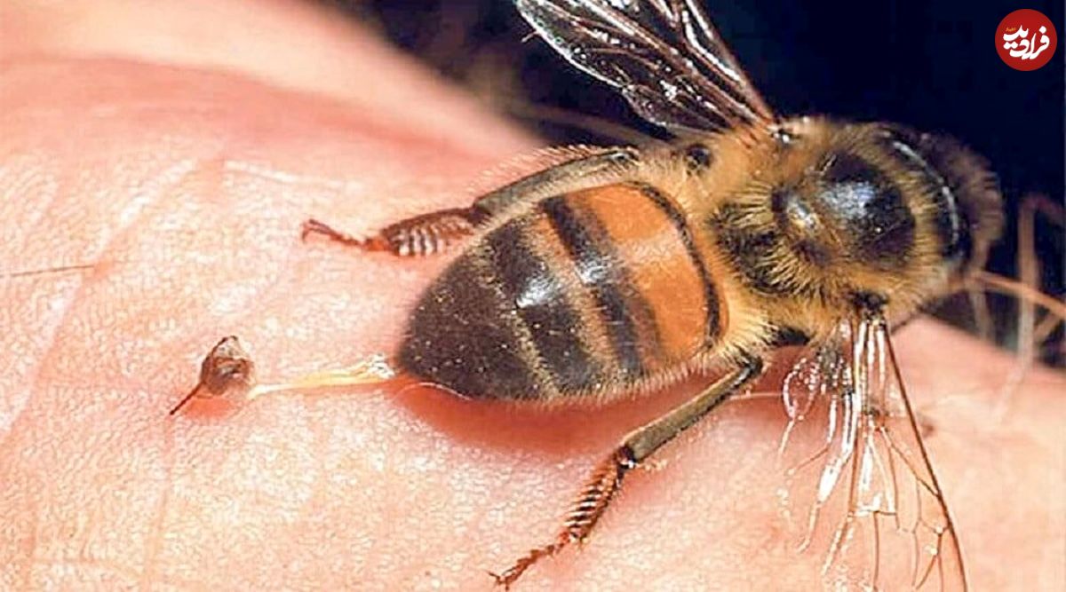 مرگ سلول‌های سرطانی با زهر زنبور عسل