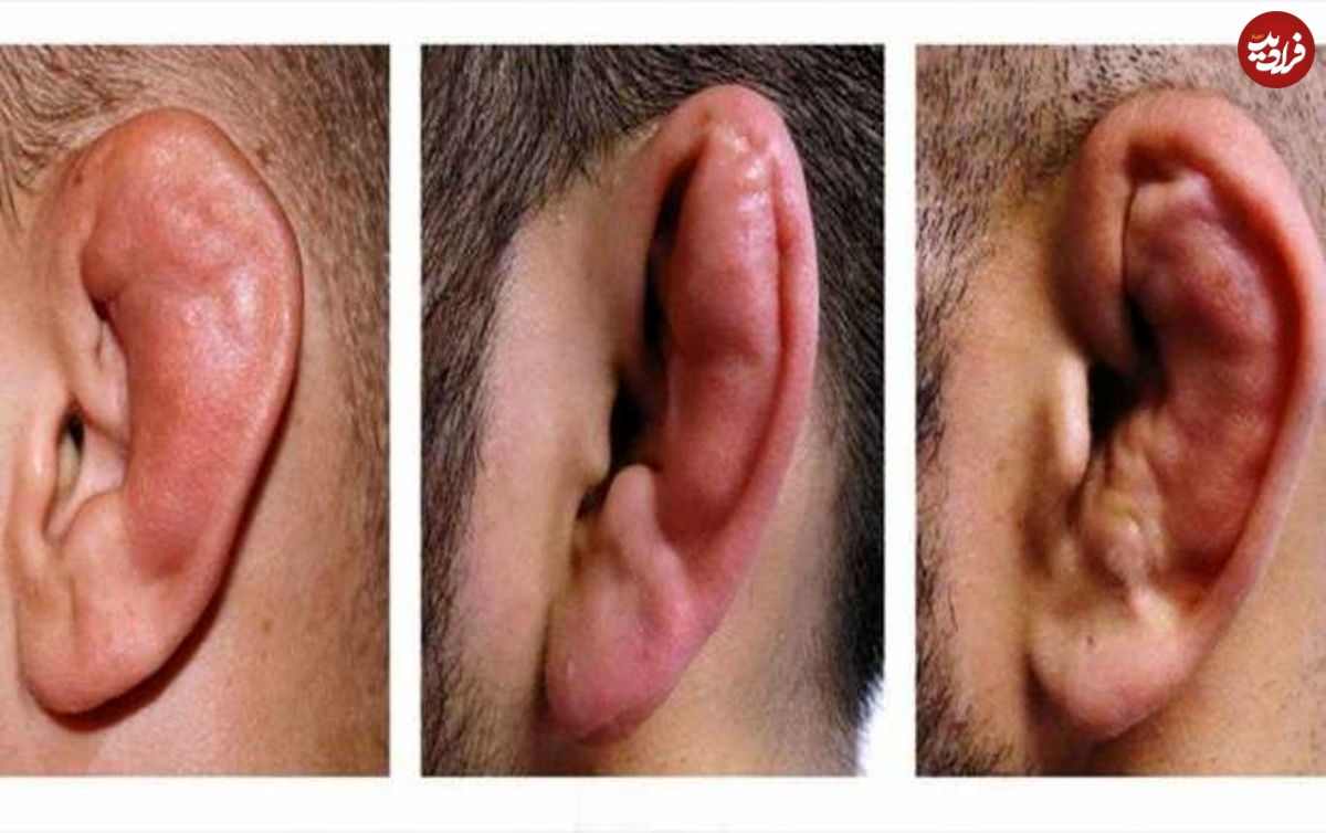 بازار داغ گوششکنی؛ از آموزش تا خدمات پس از شکست!